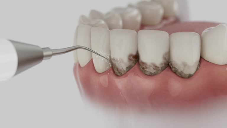 Reliable Dental contractor in Spencerville, NM by Dentist Open Now
